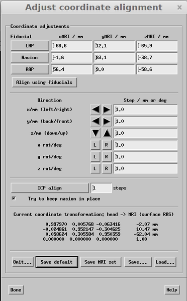File:Mne analyze AdjustCoordAlign.png