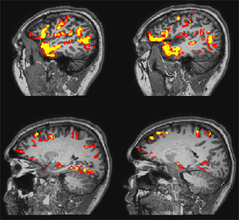 MRI brain activity images