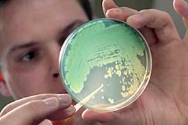 Researcher examining bacteria culture