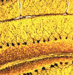 A section of the brain reveals an interweaving of nerve cells.