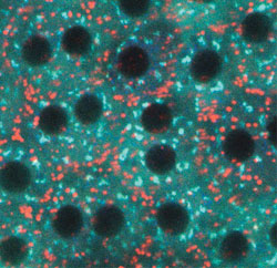 Micrograph of retinal cells.