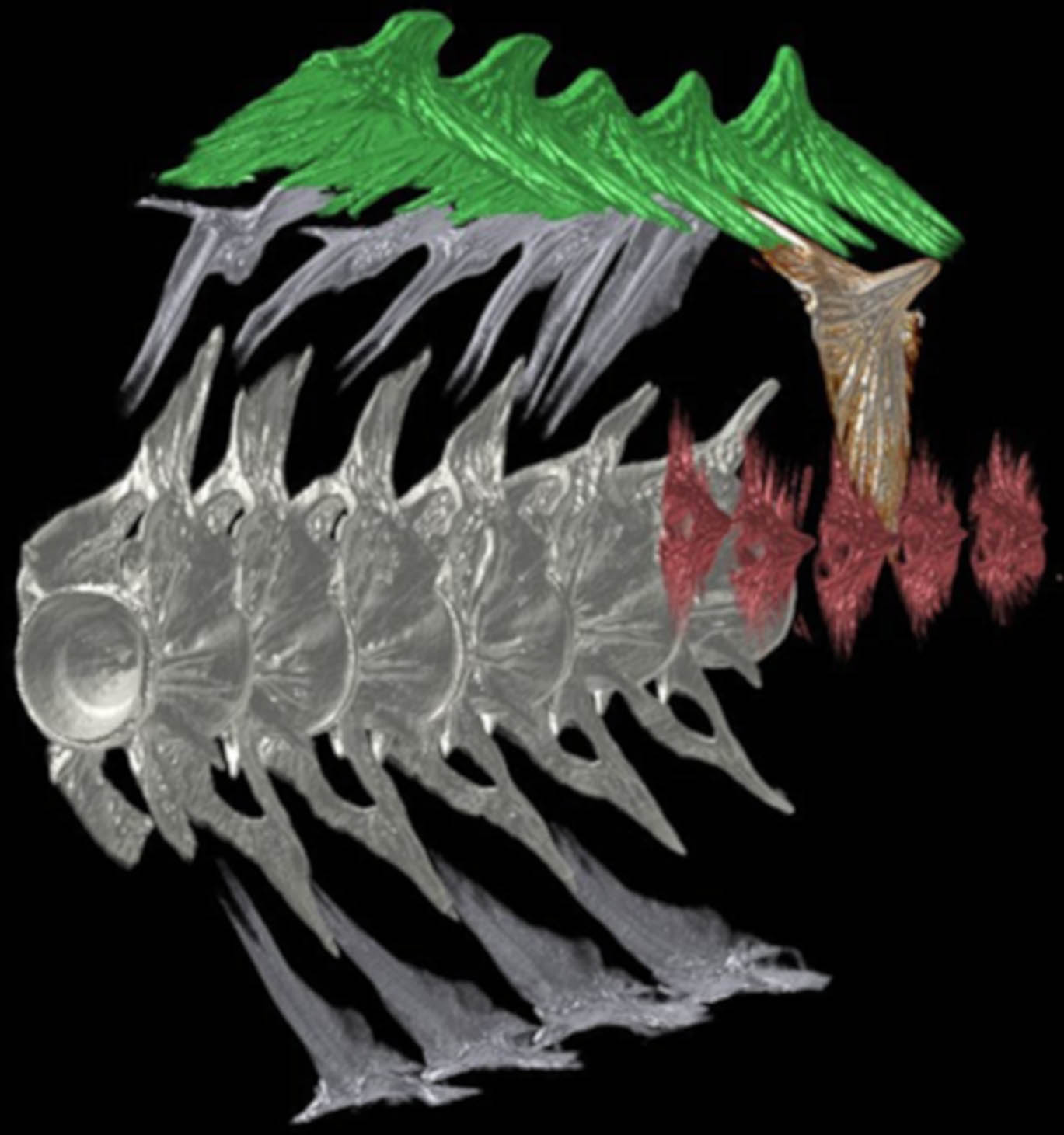 Portions of CT scan