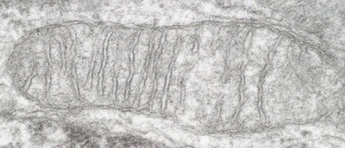 an electron micrograph of mammalian mitochondria