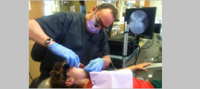 SFE Used In Dental Applications SFE Used In Dental Applications