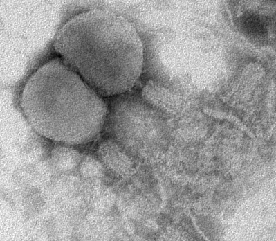 negative staining of T4 phage at 130k×