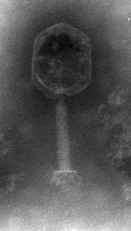 negative staining of T4 phage at 130k×