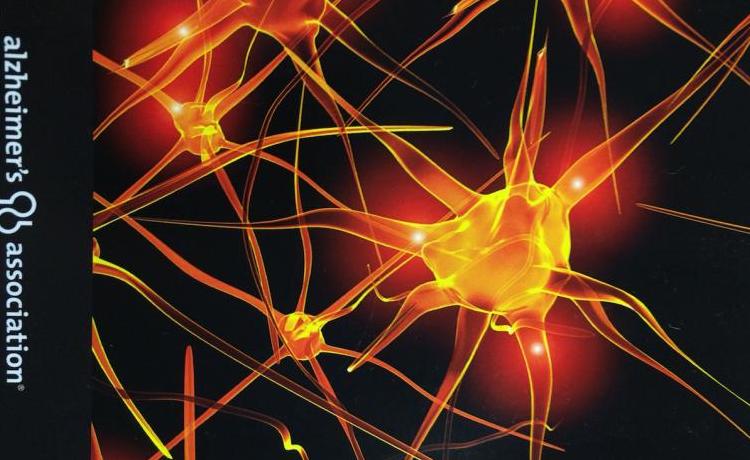 Brain enhancer foods image 4