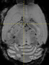 MRI of mouse brain. Credit: Millen Lab