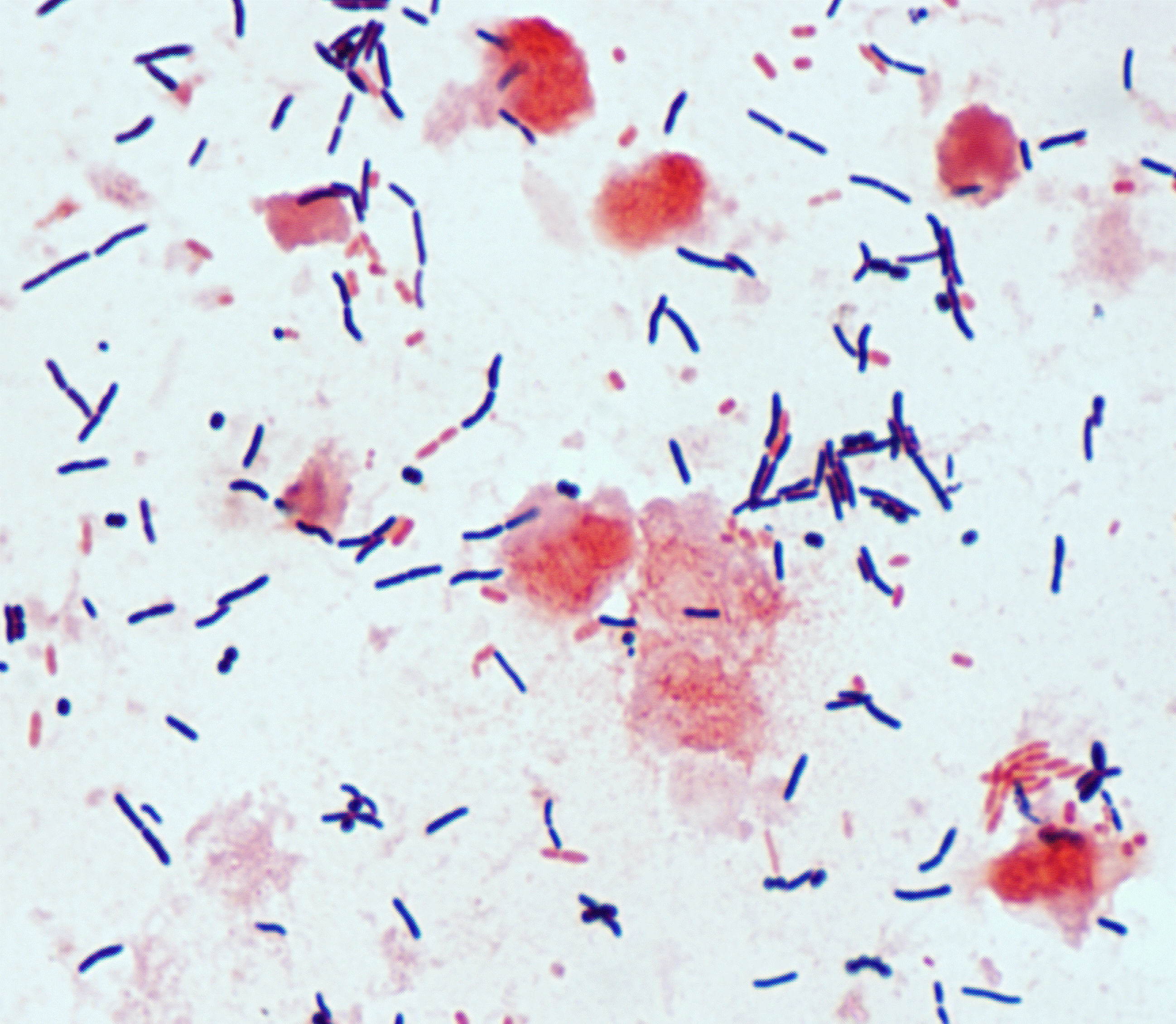 Toxigenic Clostridium difficile PCR | University of Washington ...
