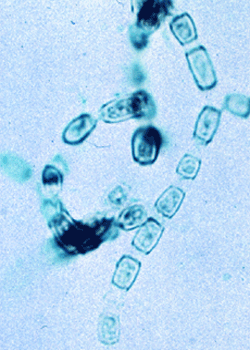 Lactophenol analine blue prep of Coccidioides immitis