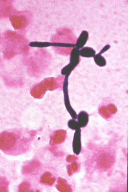 Yeast in a gram stain