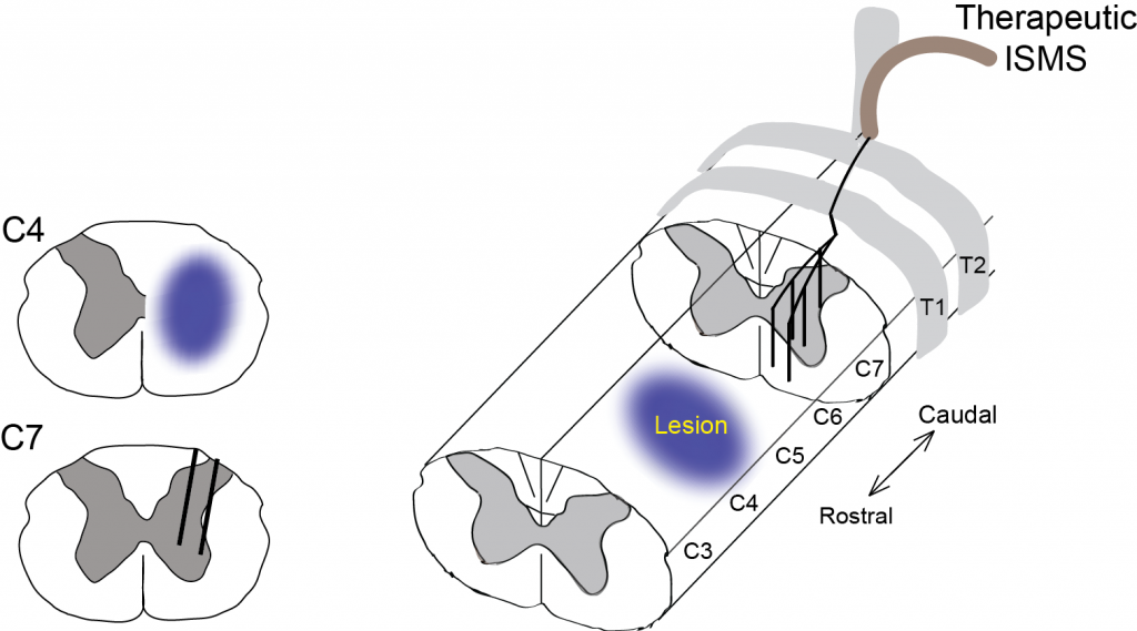 Figure 2 wire and injury schematic horizontal