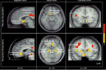 fMRI