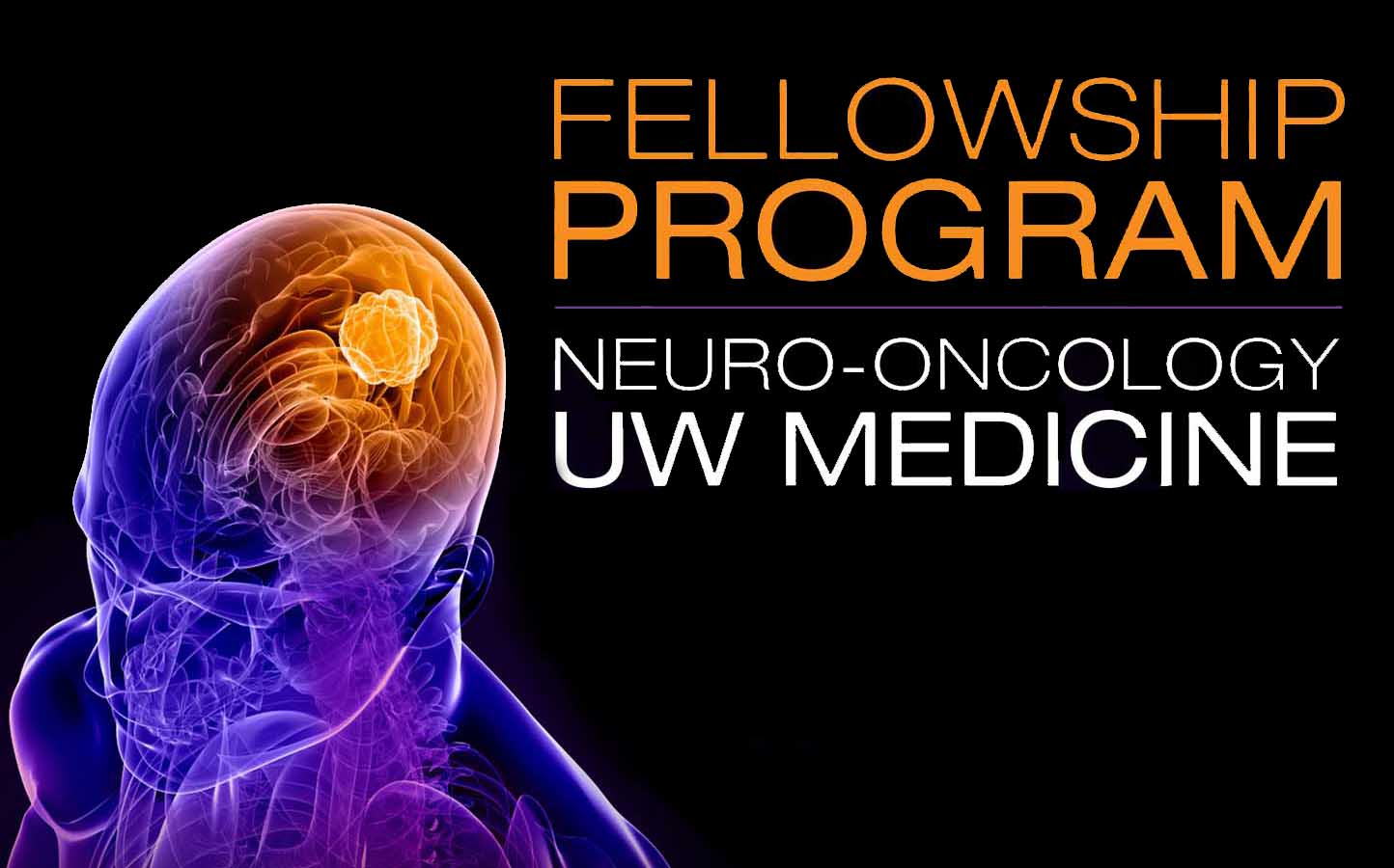 Home UW Department of Neurology