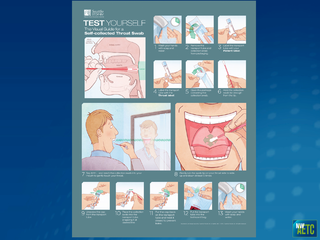 Screening for Bacterial STDs in HIV+ MSM: Incorporating Self-Testing into Routine Care by Shireesha Dhanireddy, MD Screening for Bacterial STDs in HIV+ MSM: Incorporating Self-Testing into Routine Care