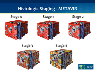 HIV and Hepatitis C: An Overview by John Scott, MD, MSc HIV and Hepatitis C: An Overview
