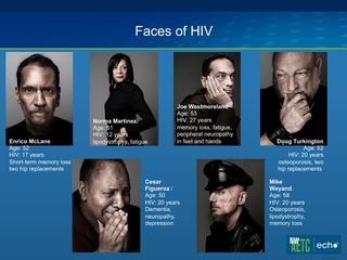 HIV and Aging by Wayne McCormick, MD, MPH HIV and Aging