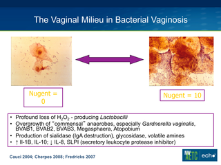 Diagnosis and Management of Vaginitis by Devika Singh, MD, MPH Diagnosis and Management of Vaginitis
