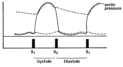 Pulmonary Stenosis Murmur Sound