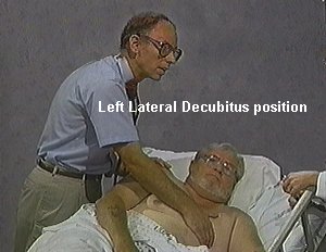 left decubitus
