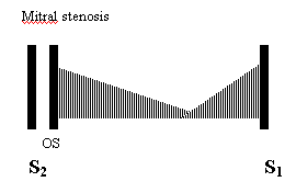 diagram showing timing of diastolic murmur of mitral stenosis