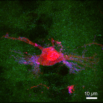 NL_Synaptophysin