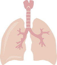 x-ray of silicosis