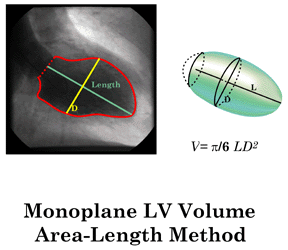 Area-Length LV Volume