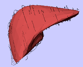liver in 3D
