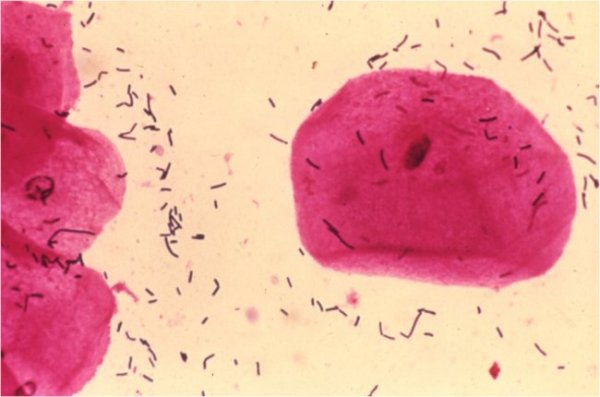 Normal Vaginal Flora