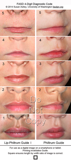 Lip Shape Chart