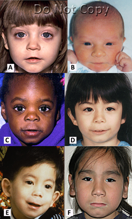 Facial Diagnosis Chart