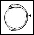 Zebrafish embryo at 3-somite stage