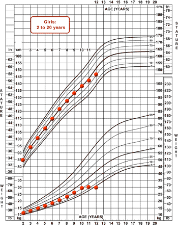 Chart showing Mandy's stature-for-age constant at the 50th percentile until age 10, then dropping down to 25th percentile by age 12; Mandy's weight-for-age constant at the 25th percentile until age 10, then falling off to 3rd percentile by age 12.