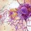 Brain inflamm microglia. credit national institute on aging, nih