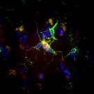 Lamp1.100xfrom20x microglia