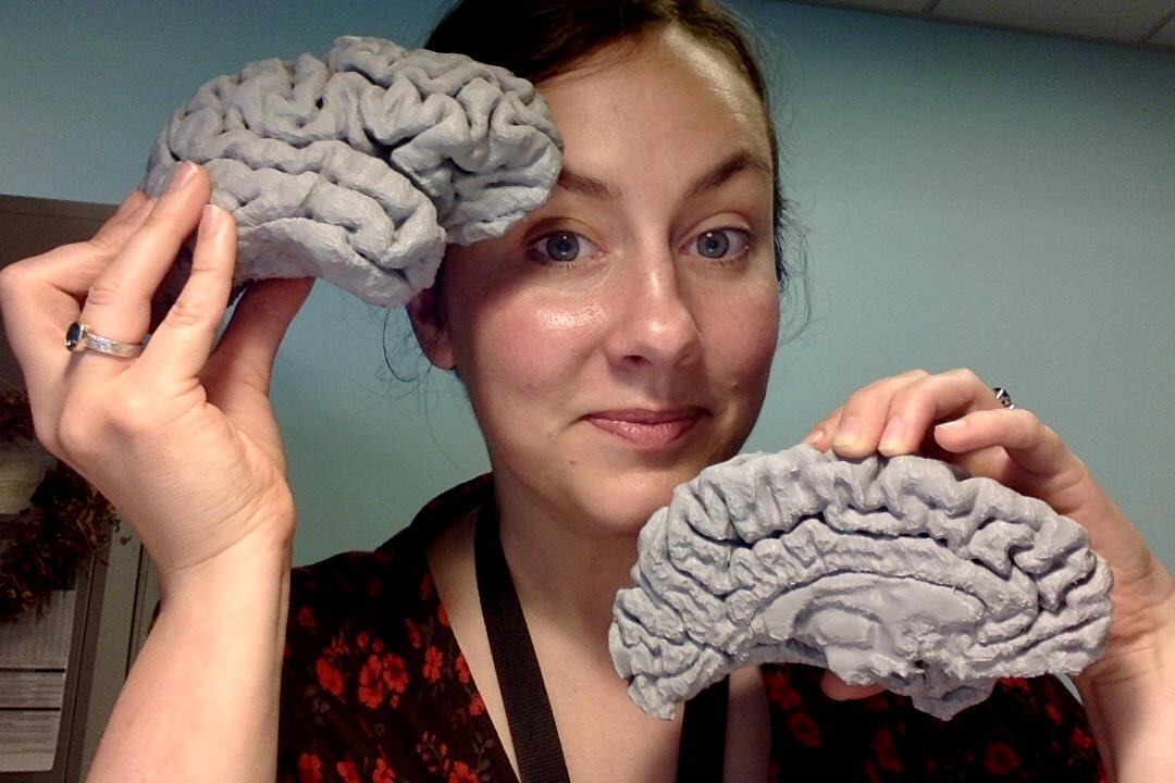 Why I - And Else - Loves 3D Brain - Memory Brain Wellness Center