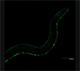 The Kraemer Lab uses this worm model to study the effects of suppressing the MSUT2 gene.