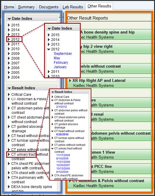 Finding Outside Reports with Epic Care Everywhere