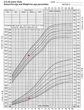 weight- and stature-for-age charts