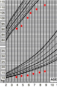 Weight- and stature-for-age charts