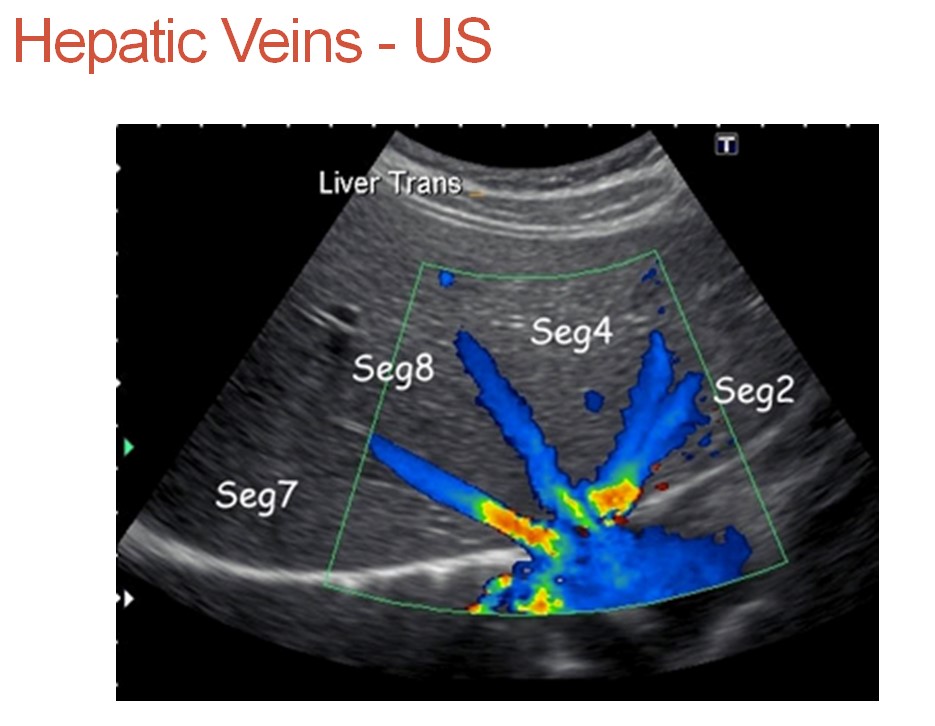 Right And Left Portal Vein Ultrasound