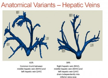 hepaticvenousvariants