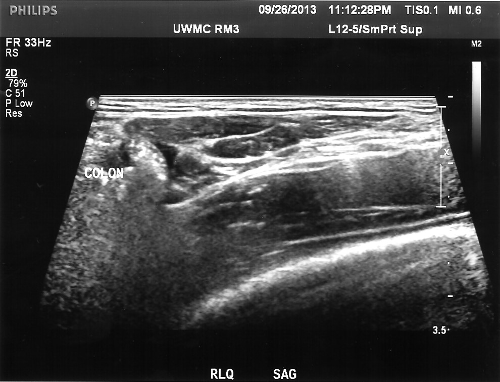 Appendix | UW Ultrasound