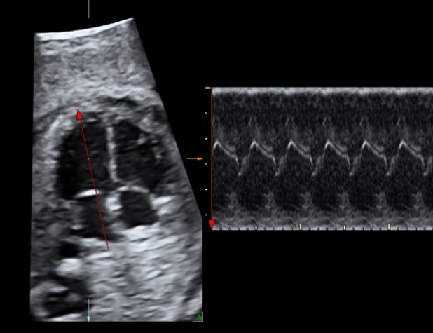 Second / Third Trimester Guidelines | UW Ultrasound