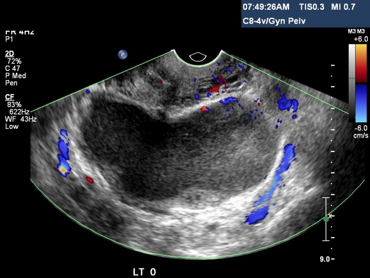 case study on ultrasound