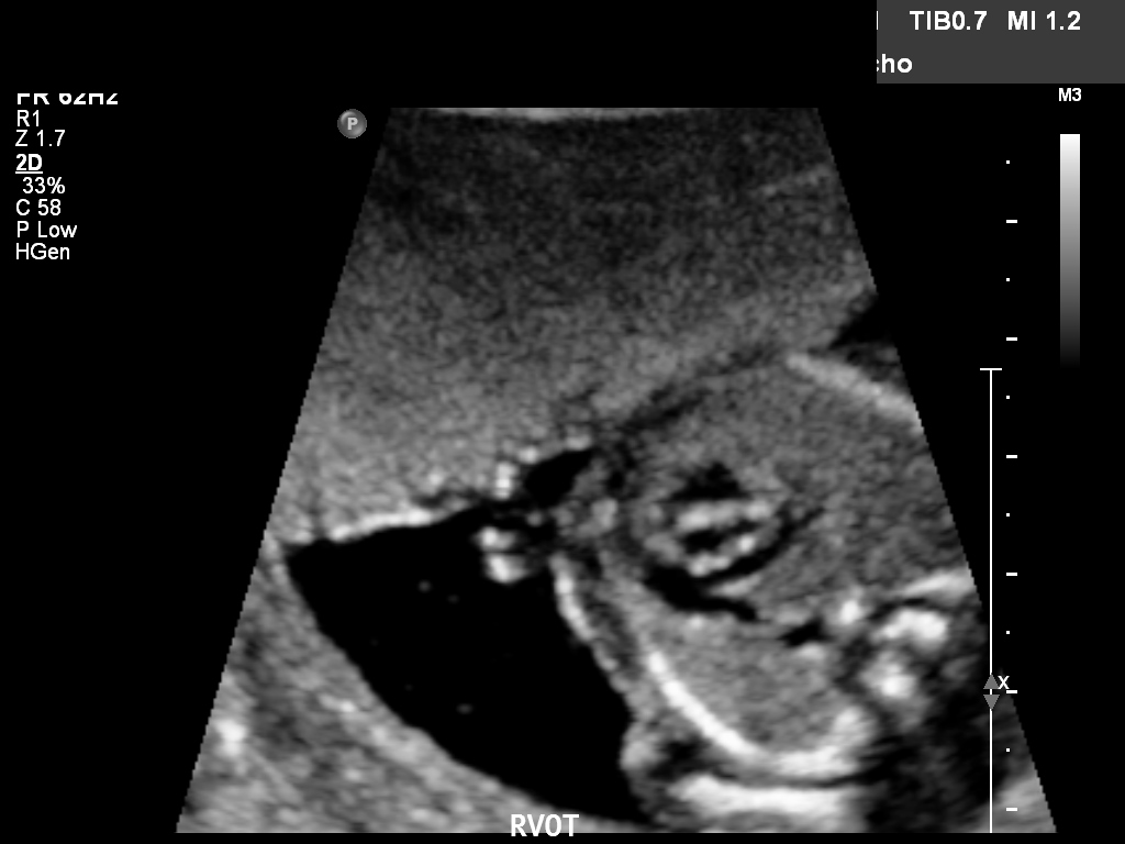 Case 5 UW MEDICINE ULTRASOUND